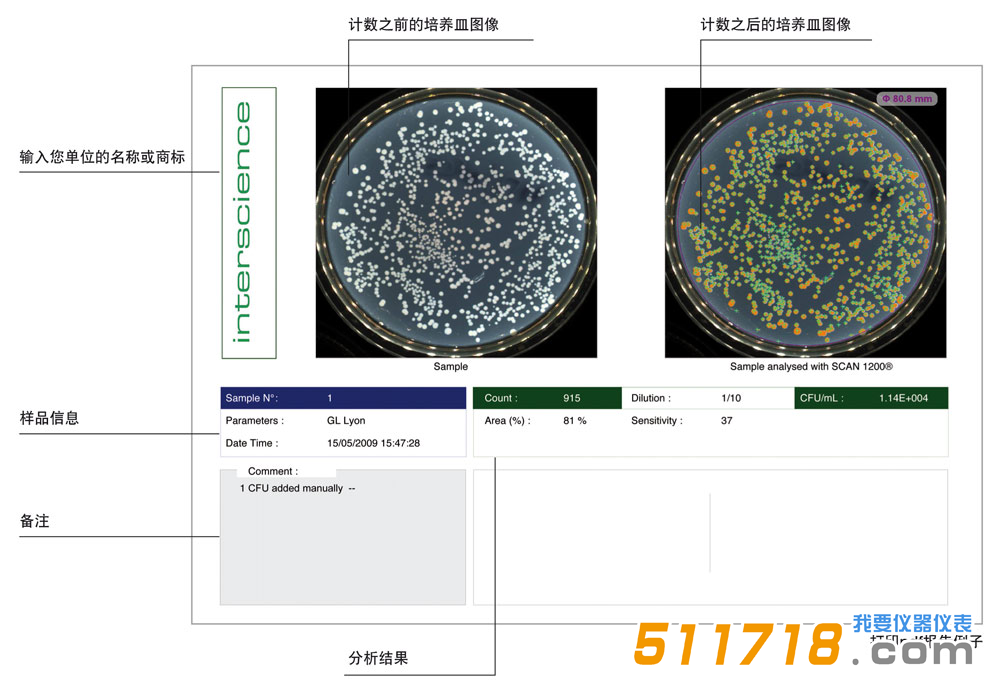 法國interscience Scan 300全自動菌落計數(shù)器2.png