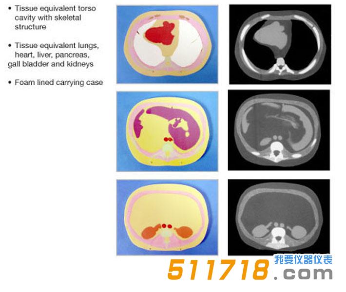 美國(guó)CIRS 600 3D截面軀干模型模體.jpg