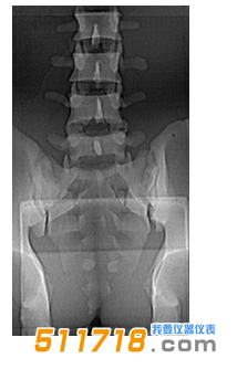 美國CIRS 034腰椎穿刺訓(xùn)練模體1.png