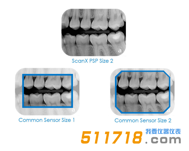 美國(guó)AIR TECHNIQUES ScanX Duo數(shù)字X射線系統(tǒng) 口腔掃描儀2.png